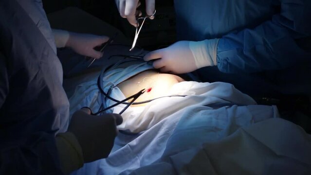 Hands of doctors sewing up tears after endoscopy operation