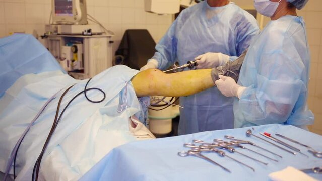 Doctor and nurse hands during endoscopic surgery on knee in clinic