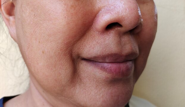 close up portrait of the wrinkle and Flabby skin beside the mouth, dullness and dark spots on the face of the woman, health care and beauty concept.