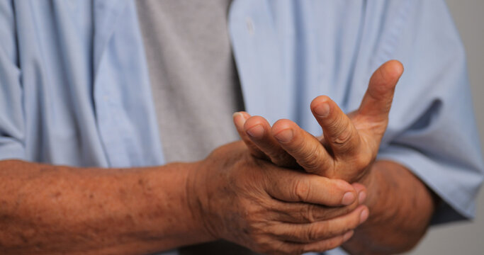An Asian man has tingling and numbness in his hand which causes beriberi.