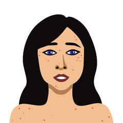 Vector image of portrait young woman with acne minimalistic