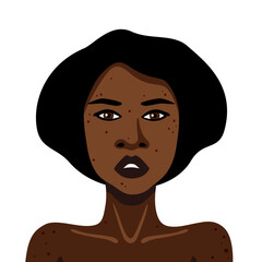Young African American woman with acne on her body on white background vector illustration in minimalistic style