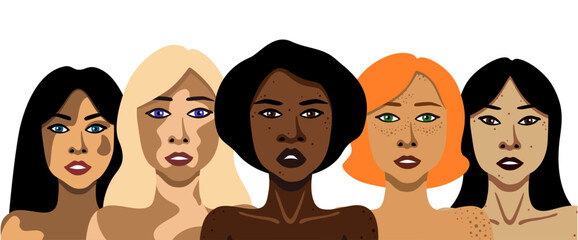 Different skin diseases in women vector illustration in minimalistic style on white background