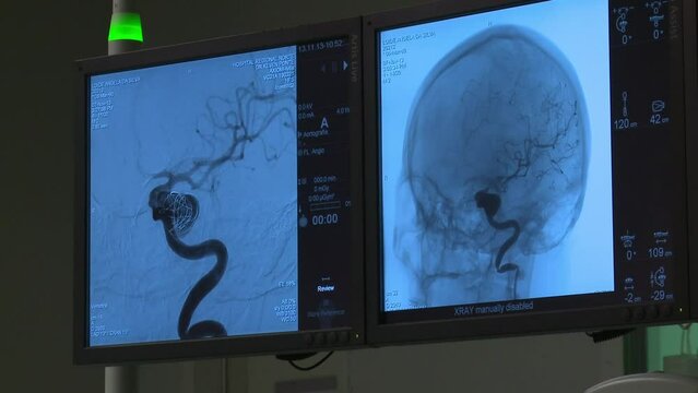 Results of patient medical scan displayed on hospital monitor screen