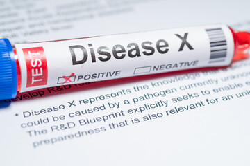 Background of Disease X.Disease X is an unknown pathogen that could cause a serious international...