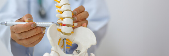 An orthopedic surgeon holds a spinal model as he demonstrates treatment methods for human spinal injuries caused by back pain during a medical consultation. - obrazy, fototapety, plakaty
