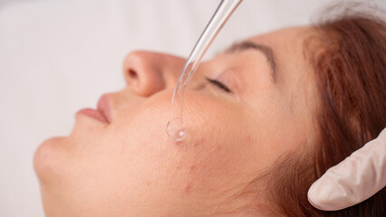 The doctor uses the darsonval apparatus against acne on the face of a female patient.