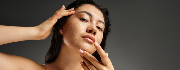 worried asian woman with bare shoulders touching wet face with acne on grey background, banner