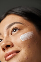 close up photo of young asian woman with brunette hair and treatment cream on acne prone skin
