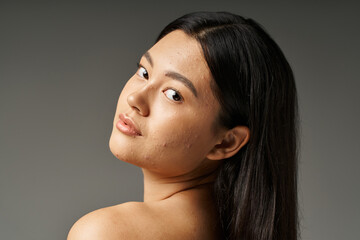 asian young woman with skin issues and bare shoulders looking at camera on grey backdrop, acne