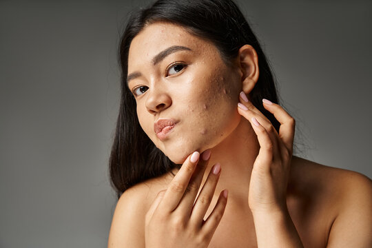 young asian woman with brunette hair and naked shoulders touching acne prone skin on grey background