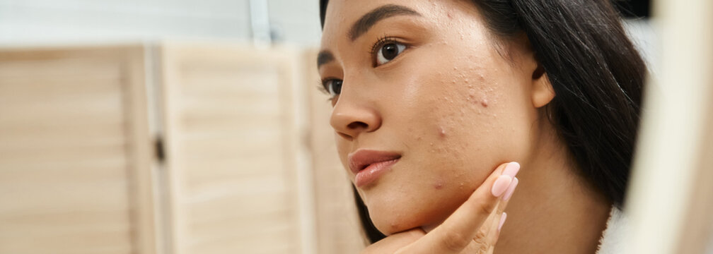 young asian woman with brunette hair and acne prone skin looking at mirror in bathroom, banner