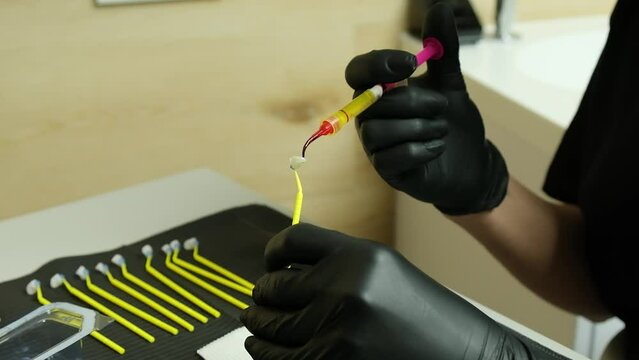 The preparation process for ceramic veneers. Application of hydrofluoric acid
