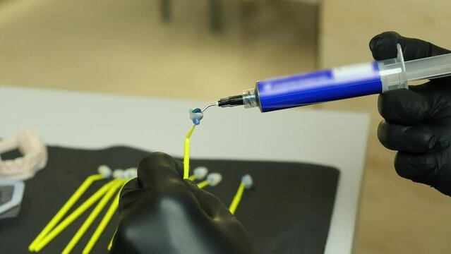 The use of hydrofluoric acid for ceramic veneers