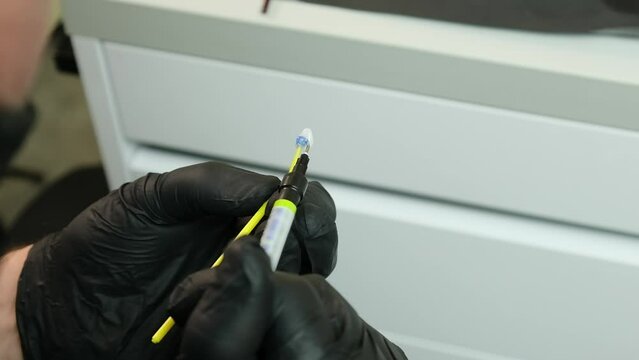 The use of hydrofluoric acid for ceramic veneers