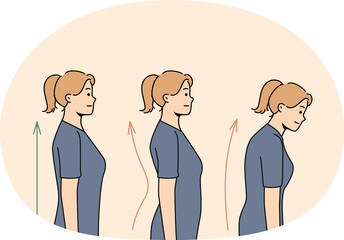 Set of young woman posture correction. Collection of female with and without back problems. Healthcare and physiotherapy.