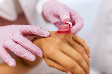 Doctor applying protective cream on patient's hands