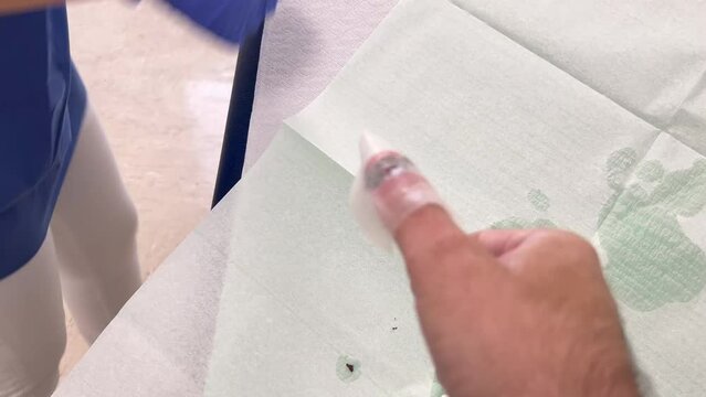 Infection after the nail is removed, the doctor cleans the infected wound on the finger. placing the mesh