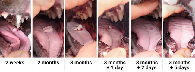Progression of oral papilloma wart on dog tongue. Visualization of oral wart stages on young dog including falling off and healing. Benign tumor or  contagious papillomavirus. Selective focus. - obrazy, fototapety, plakaty