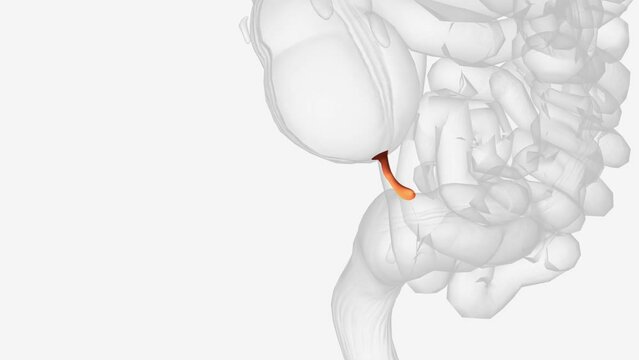 The appendix is a small pouch attached to the end of the large intestine .