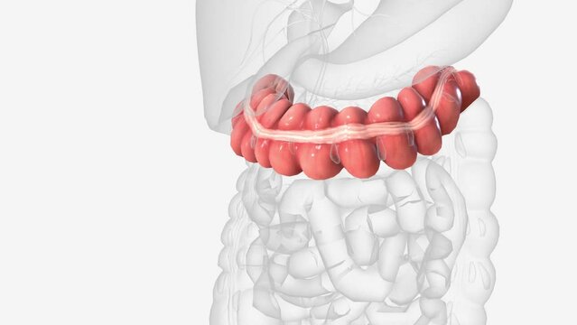 The transverse colon is the lengthy, upper part of the large intestine .