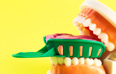 Green dental spoon for taking a dental impression in a mock-up of a dental jaw on a yellow...