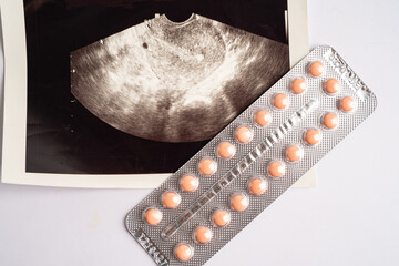 Birth control pills with ultrasound scan of baby uterus, contraception health and medicine.