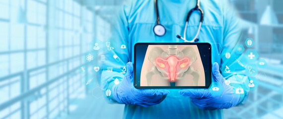 image of uterus on doctor's tablet. Cervical cancer, uterine fibroids, hysterectomy. Female...