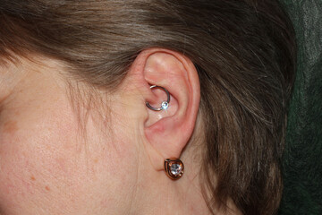 Ear cartilage piercing on a woman. Macro. Daith piercing + ball captive ring with cubic zirconia.	 - obrazy, fototapety, plakaty