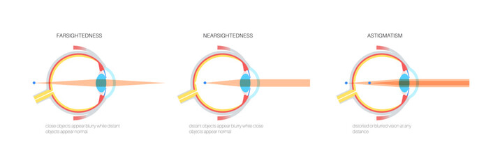 Farsightedness and nearsightedness - obrazy, fototapety, plakaty