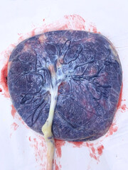 A placenta with umbilical cord on a white table after birth