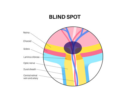 Blind spot poster