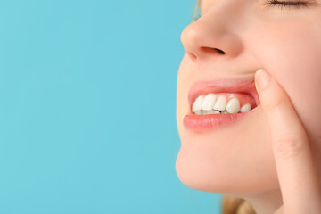 Obraz premium Teenage girl showing teeth on blue background, closeup