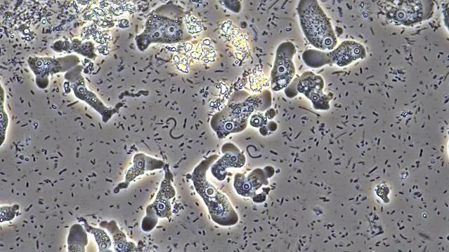 timelapse of a swarm of amoebas crawling over a microscope slide. 400x magnification, phase contrast