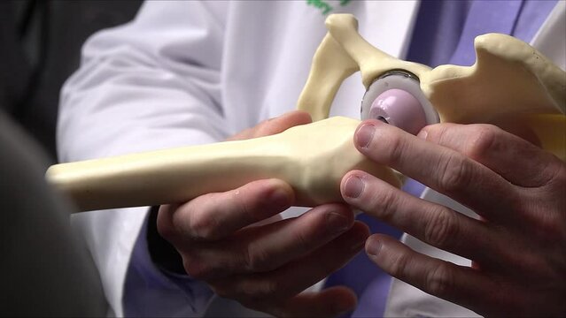 Doctor demonstrating with artificial hip model