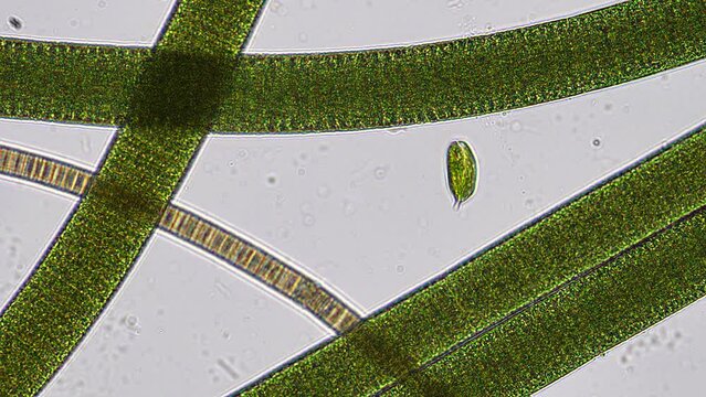 Euglena phacus trapped between a forest of filamenous cyanobacteria. Phacus swims with a beautiful corkscrew motion. Shot in real time under the microscope at 200x magnification.