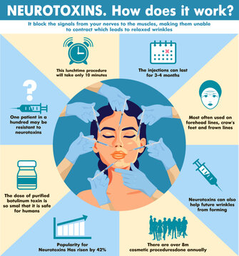 Neurotoxins. How it works Infographics. Neurotoxins injection. Woman facial wrinkle treatment. Medical cosmetic procedures for face skin. Beauty, cosmetology, anti-aging concept. Vector