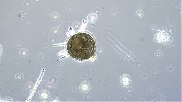 A testate amoeba, Diffulgia coronata, under the microscope at 200x magnification in phase contrast. This time lapse highlights its extending pseudopods, used to move, probe the environment and feed.