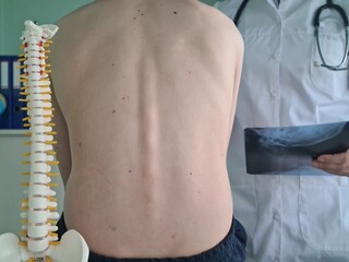 Back of a teenager with a spine clinic