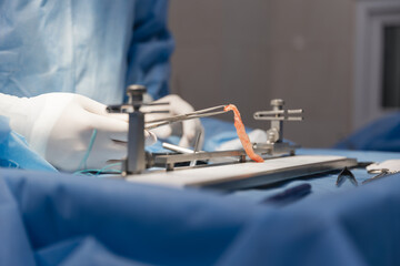 surgeons work on the cut part of the knee joint (muscular ligament) before implanting it back into...