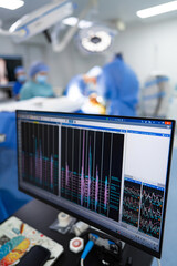 Monitor in the operating room with the doctors and nurses in the background