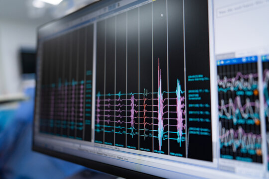 Computer screen showing graph and other data