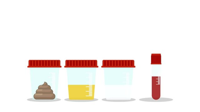Urine, stool, sperm and blood analysis. Urine, stool, sperm and blood test icon. Medical analysis laboratory test. Medical samples.