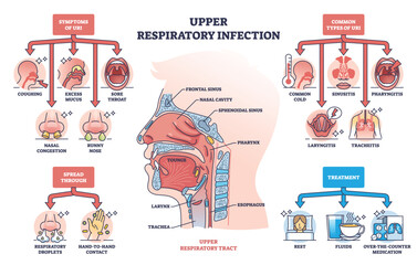 Upper respiratory infection with symptoms and types outline diagram. Labeled educational health condition scheme with coughing, sore throat and nasal problems vector illustration. Medical description