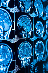 human brain scans, x-ray
