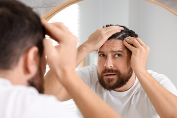 Man with dandruff in his dark hair near mirror indoors