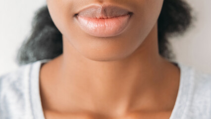 Aesthetics cosmetology. Lips enhancement. Care balm. Unrecognizable attractive woman soft...