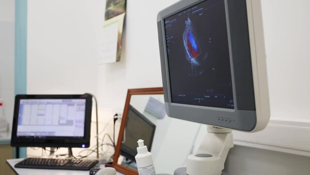 Ultrasound system with an image of human organ at display in hospital.