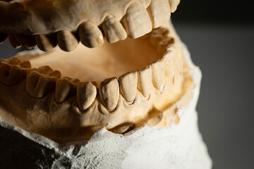 The image of a denture	