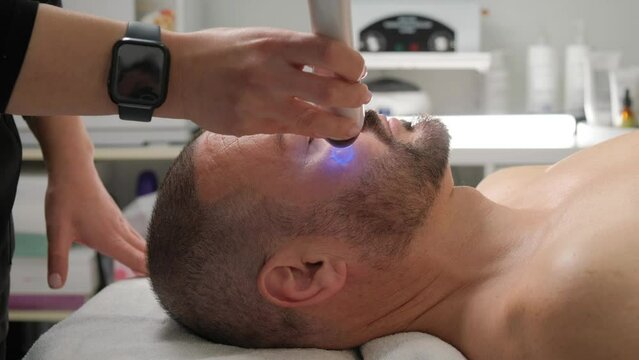 Closeup portrait of a handsome man with a beard microneedling with dermapen from a beautician.